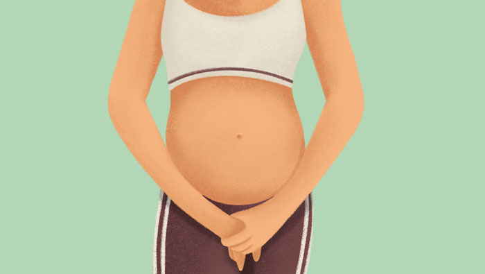 Ilustración de una mujer embarazada con candidiasis