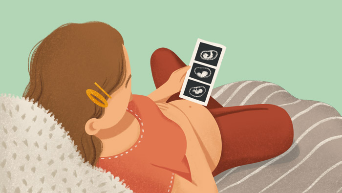 Ilustración de una mujer viendo su saco gestacional en una ecografía