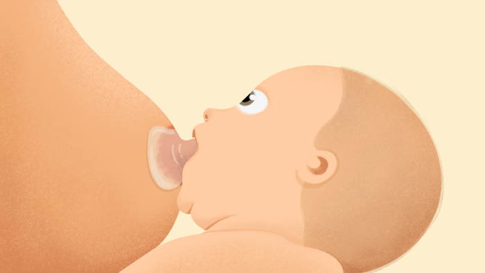 Bebé utilizando pezonera en la lactancia materna