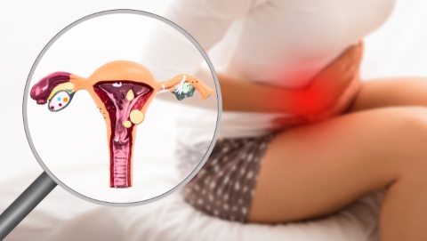 endometriosis embarazo natural