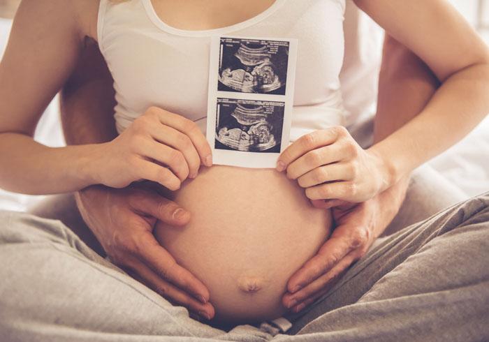 Pareja mostrando la ecografía de un embarazo gemelar