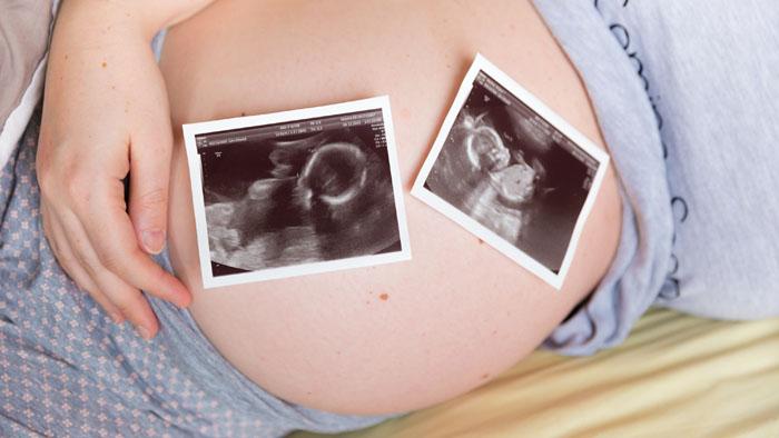 Mujer embarazada de mellizos mostrando su vientre con dos ecografías