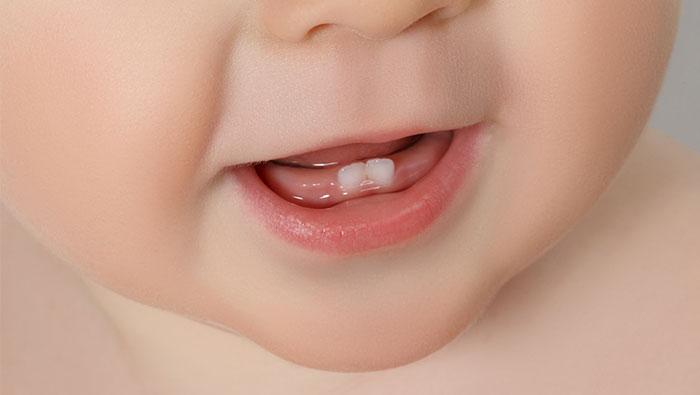 Boca de un bebé al que le están saliendo los dientes
