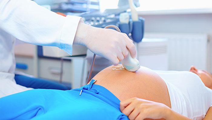 Médico realizando una ecografía doppler a una embarazada