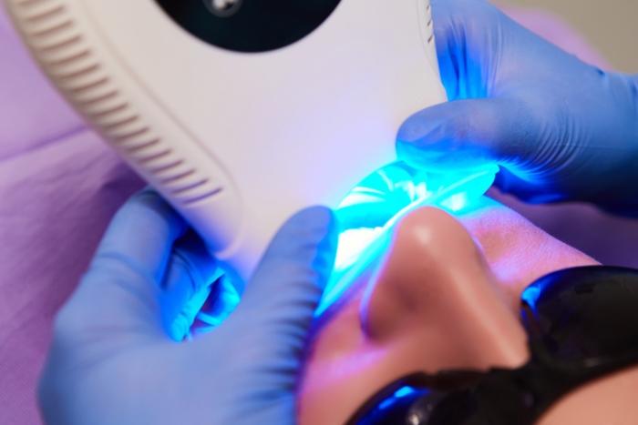 cómo tener los dientes más blancos tratamientos